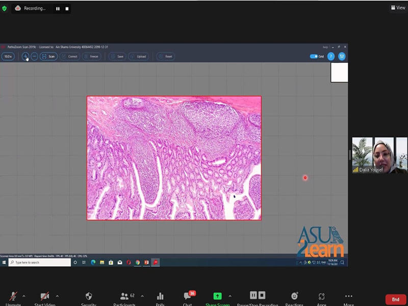 جلسة تدريبية على منظومة الميكروسكوب الافتراضي ومنصة الصور عالية الدقة