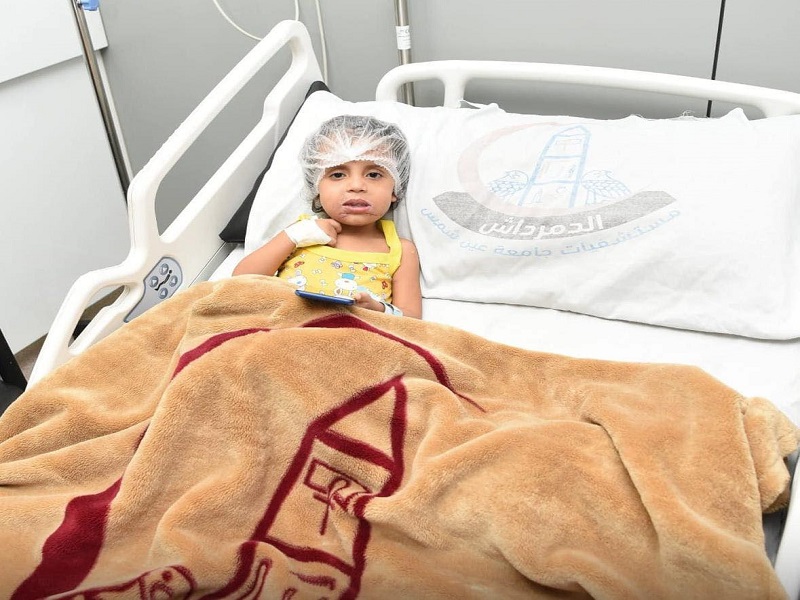 Ain Shams University Hospitals Rescue Young Child Following Severe Injuries from Dog Attack